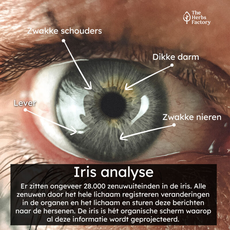 iris analyse, iridologie