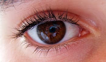 onduidelijke foto oog iris analyse